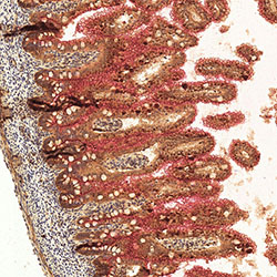 sars-cov-2 gene expression in a human fetus